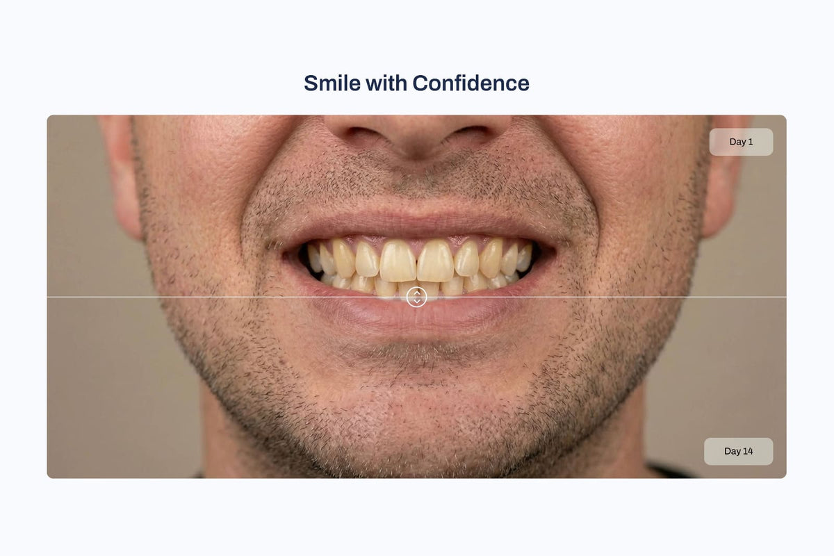 Before & after images 2